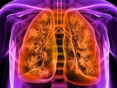 Chronic Disease Part 2: Chronic Obstructive Pulmonary Disease&nbsp;(COPD)