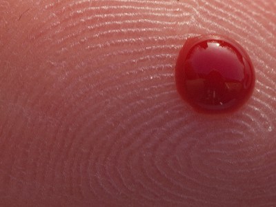 PT/INRs: Helping Patients Manage their&nbsp;Anticoagulation